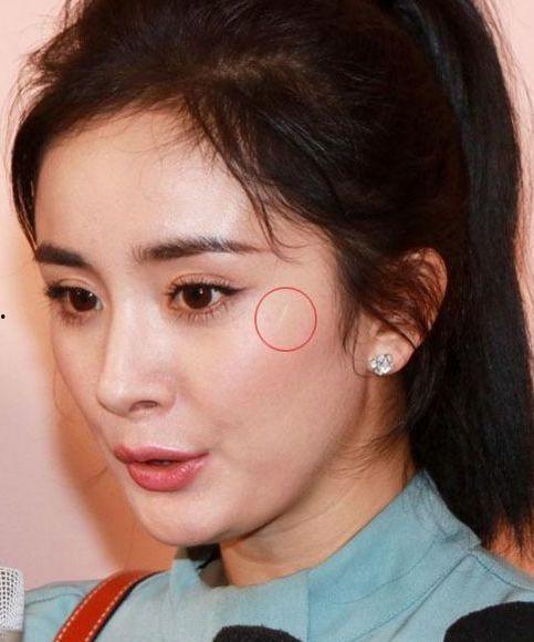 脸上有伤疤的明星